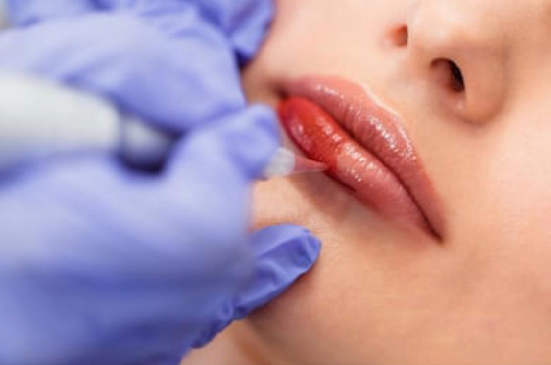 Lippen